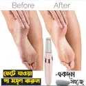Electronic Foot Callus Remover