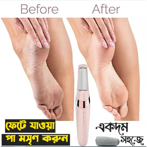 Electronic Foot Callus Remover