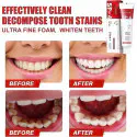 SP-4 Ultra Probiotic Toothpaste