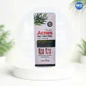 Acne Oil Control Serum