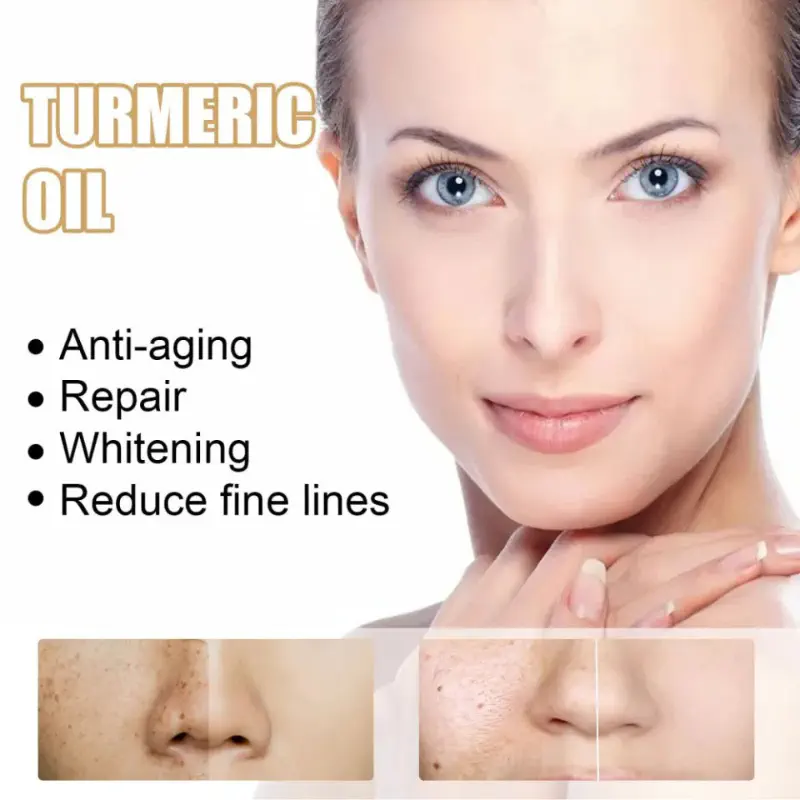 EELHOE TURMERIC OIL...