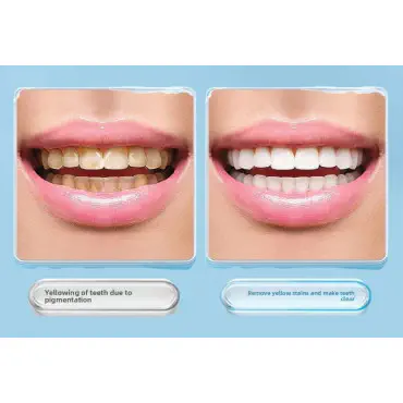 Tooth Stain Eraser B...